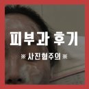 [피부일기] 일주일만에 또 갔어요..피부과..