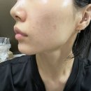 주식회사 제이바이오 | 30대 피부관리 꿀템 비타민C 화장품 추천 순수비타민 미백앰플 리얼비나타인 후기