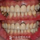 서울리멤버치과의원 이미지