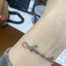 놀타투 | 대구 타투제거 내돈내산 후기 3회차
