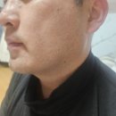 하이메디텍 | 얼굴작아지는 아트메디텍 브이라인밴드 리프팅밴드