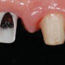 즐거운치과기공소 이미지