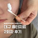 대구 동성로 한의원에서 패인흉터 새살침으로 치료 받고 온 후기 2회차