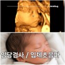 (주)예인 | 청화병원 임당검사 / 임신당뇨 재검 / 입체초음파 GPT 프롬프트 후기