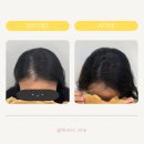 덴스에스엠피