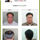 모터치 - 거제시 고현로 95 | 여성가발, 남성가발, 항암가발 ~ 모터치 체험단 후기예요 ^^;