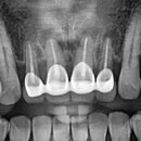 웰치과기공소 이미지