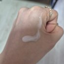 오알지 | 아크네 오알지 사용후기 / 턱 여드름