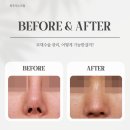 최우식노즈립성형외과의원 이미지