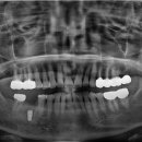 열린오치과의원 이미지