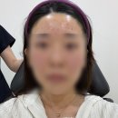 차스킨 - 수원시 권선구 하탑로30번길 27 | 모공 프로젝트 시작.. 울산 쥬베룩 스킨 + 시크릿레이저 내돈내산 1회차 후기