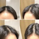 나진환지구과학연구소 | 탈모방지샴푸 감당하기 힘들때