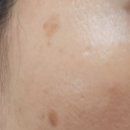 봄날내과의원 이미지