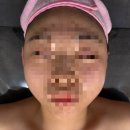 여신뷰티 | [울산/태화동] 예비신부가 선택한 윤곽성형 마사지 울산 피부관리 여신뷰티 솔직후기