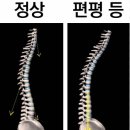 필라테스(야) 이미지