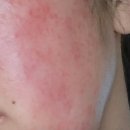 채운 | 민감성 피부 수분 채운 후기