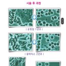 일본에서 유일한 관리형 의료기기 오키나와주열기, 주열기 사용법, 미쯔이주열기ocn-k 별희 주열기3편