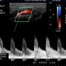 호두까기 이미지