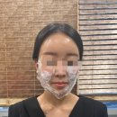 겨울 피부 속당김과 피부 탄력은 전주피부과 미하이의원에서 전주스킨부스터로 해결 완료!