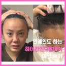 헤어뉴스 | 강남 밴스모자이너의원 헤어라인모발이식 예약 후기ㅣ여성탈모병원 선택 기준 공유