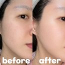 이노뷰티 | 뷰티디바이스 후기｜올인원 뷰티디바이스 '이노세라 알파'로 30대 홈케어, 탄력·피부결 관리 효과까지...
