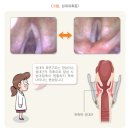 쉼 이미지