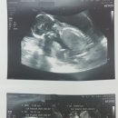 아마존여성의원 이미지