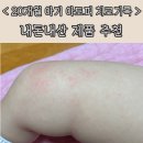 자르트카케어 | 20개월 아기 아토피 내돈내산 제품 추천 아기 아토피 탈출 성공 !