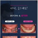 서울니어치과 이미지