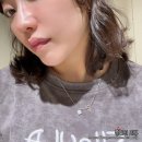 베러미의원 | 잠실 온다리프팅 6만줄 후기 _ 베러미의원 잠실점에서 온다리프팅+주름 보톡스 내돈내산 후기
