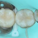 부여치과기공소 이미지