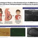 닥터오-백신과 자폐증의 인과성을 인정한 미질병통제센터 이미지