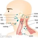 귀밑 목 임파선염 원인 및 (임파선 혹, 목에 턱밑 멍울). 이미지