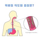 역류성 식도염에 좋은 음식과 나쁜 음식들 이미지