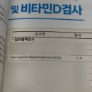 친친약국 | 임산부 영양제 ・ 고운자임맘, 철분제 헤모콤 내돈내산 추천