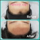 신세계 홈파티스 스튜디오 농성점 | 광주광천왁싱 // 헤어라인 정리하러 농성역왁싱 전문 아나덴 슈가링왁싱 광주광천점