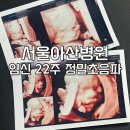 아산더편한산부인과의원 | [임신 22주] 서울아산병원 산부인과 쌍둥이 정밀초음파 : 비용, 소요시간, 입체초음파, 크기차이