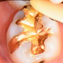 내이처럼치과병원 이미지