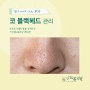 이서영피부관리