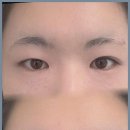윤메디케어 | 가평속눈썹 가평 윤이나다, 피부 건강의 비밀은 여기에!