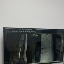 에이스병원 | [안산] 에이스병원 입원후기/척추뼈 시멘트 시술/내돈내산/병원만족후기