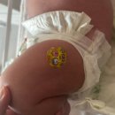 99서울소아청소년과의원 | 99서울소아청소년과의원 파랑방 예약방법 속닥속닥어플 / 2개월 예방접종 헥사심, 로타텍, 폐렴20가