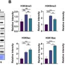 히스톤(HisTone) 이미지