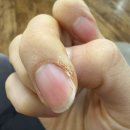 천욱부피부과의원 | 부산 서면 줄서는 피부과 천욱부피부과 방문후기