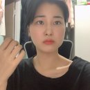 힐링윤치과의원 네이버블로그