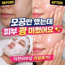 정드림메디컬의원 | 💖덕천피부샵 꿀피부 만든 올가드림뷰티 덕천포레나점 후기💖