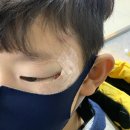 에뉴한서성형외과