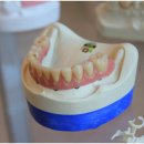 열린치과기공소 이미지