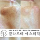 끌라르떼에스테틱 네이버블로그