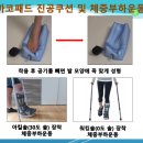 솔 보조기의료기 | 파열 수술 후 깁스/아킬레스건 재건 수술 후 깁스/아킬레스건 각도조절 보조기/발목 각도조절 보조기
